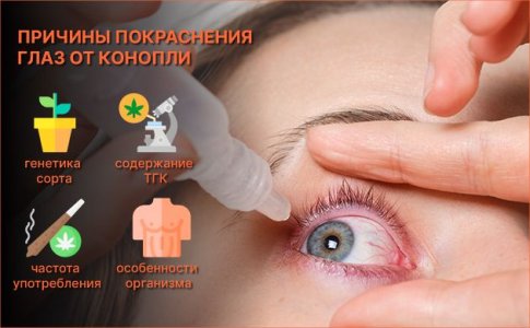 Причины красных глаз от марихуаны Причины красных глаз от марихуаны